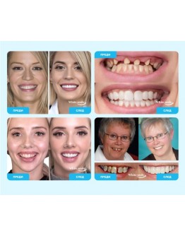 Декоративни изкуствени зъби Snap on Smile